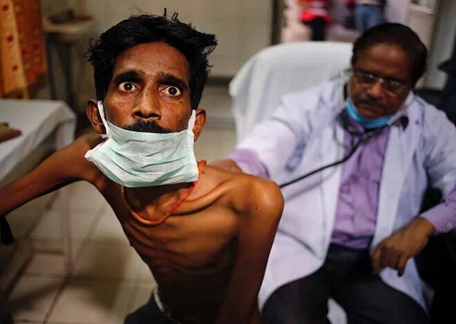 TB patients: टीबी रोगियों को मासिक सहायता 500 से बढ़ाकर 1000 रुपए