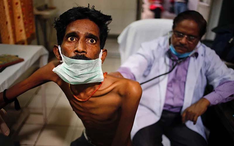 TB patients: टीबी रोगियों को मासिक सहायता 500 से बढ़ाकर 1000 रुपए