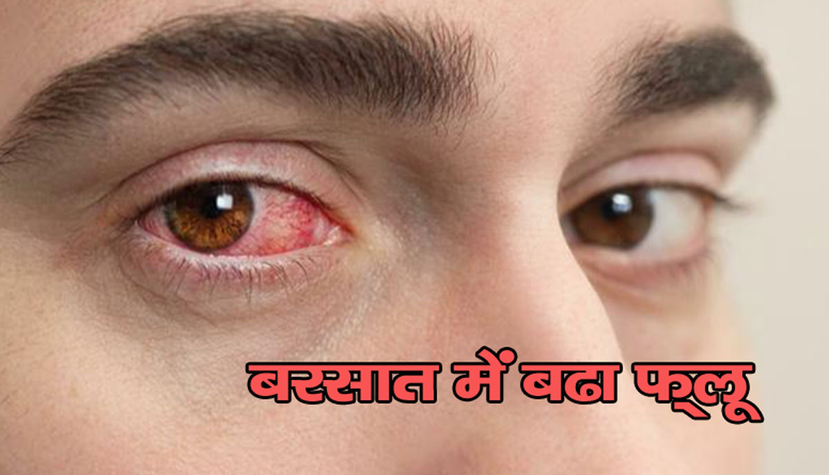 बदल रहा है मौसमः बढ रहा आई फ्लू, आंखों का रखिए ऐसे ख्याल